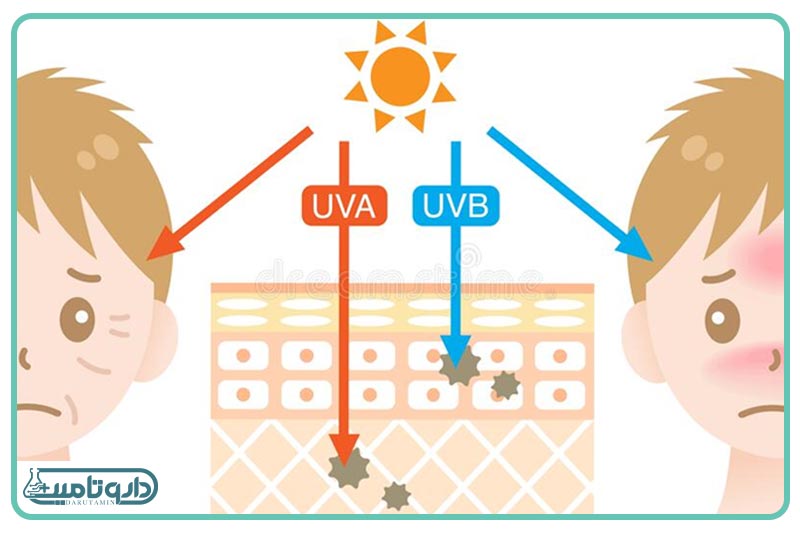 انواع اشعه UV خورشید