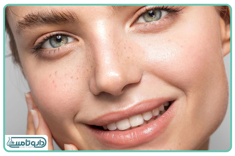 اویدرم کرم مرطوب کننده و آبرسان (مناسب پوست چرب)