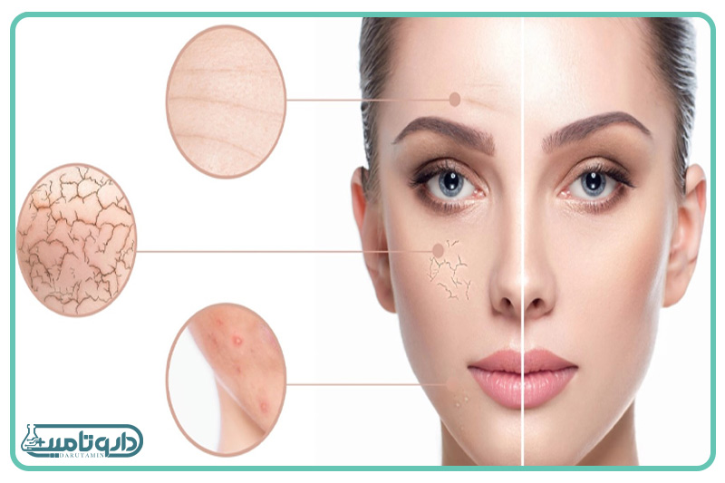 ژنوبایوتیک کرم رطوبت رسان صورت و گردن مخصوص پوست خشک و حساس