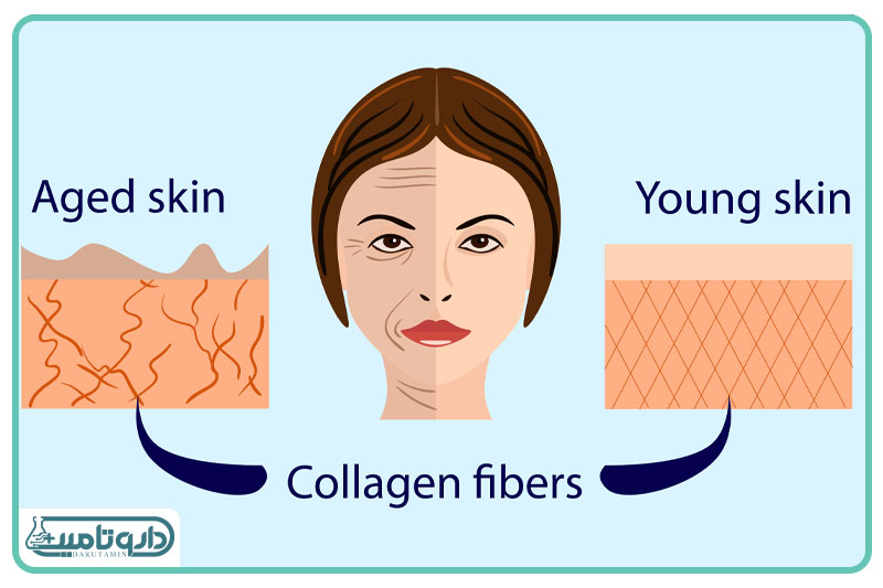 کلاژن سازی پوست